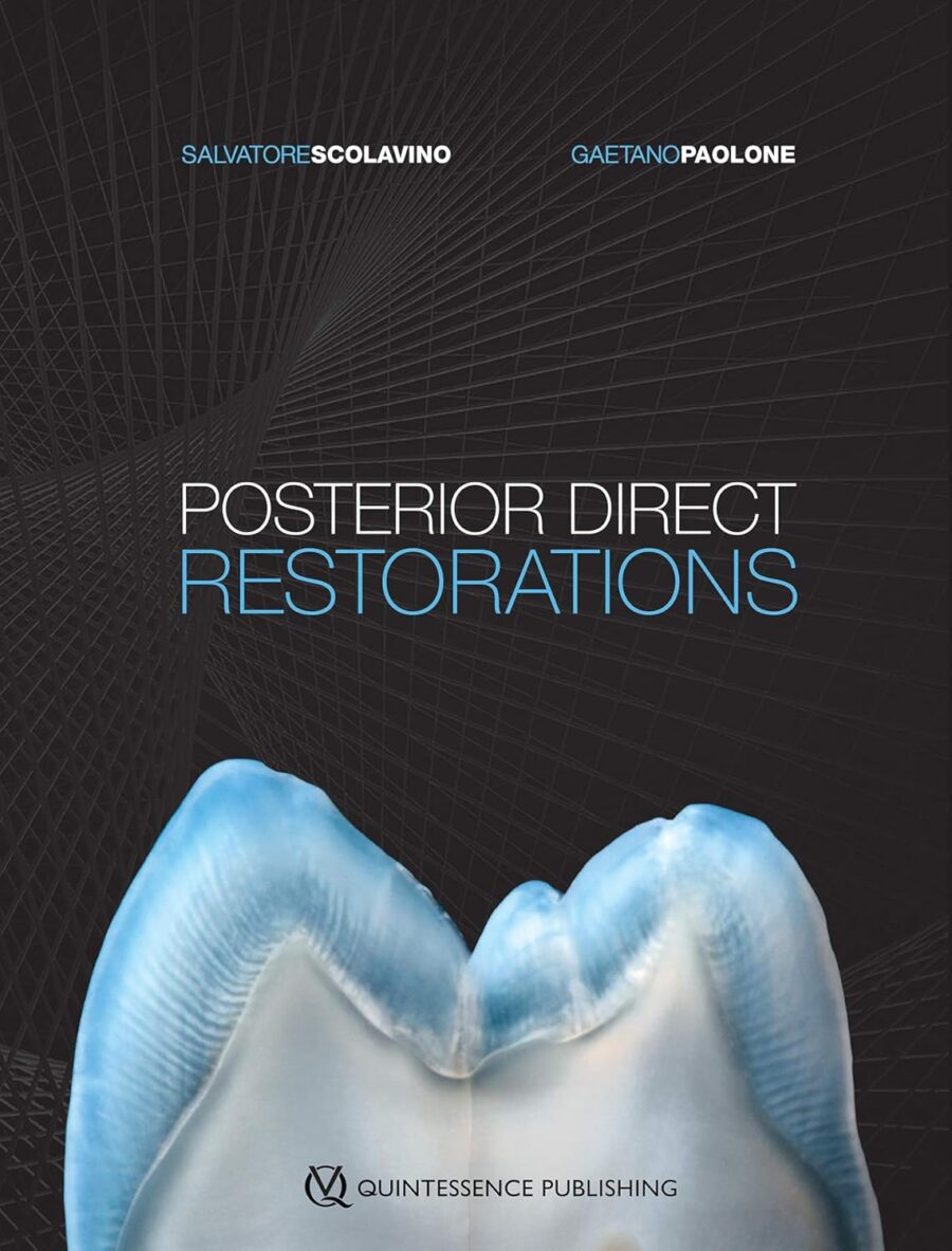 Posterior Direct Restorations 1st Edition