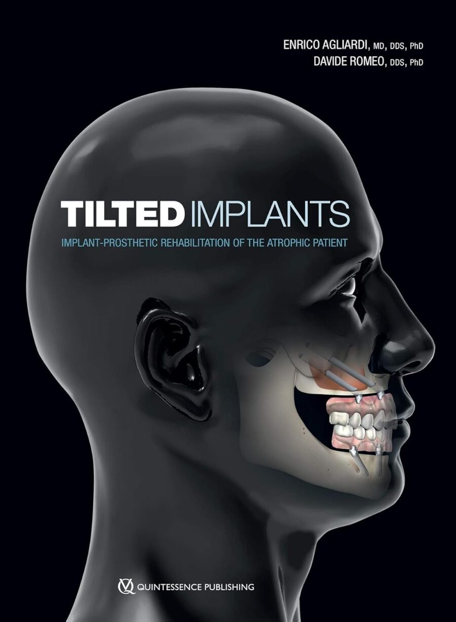 Tilted Implants: Implant-Prosthetic Rehabilitation of the Atrophic Patient