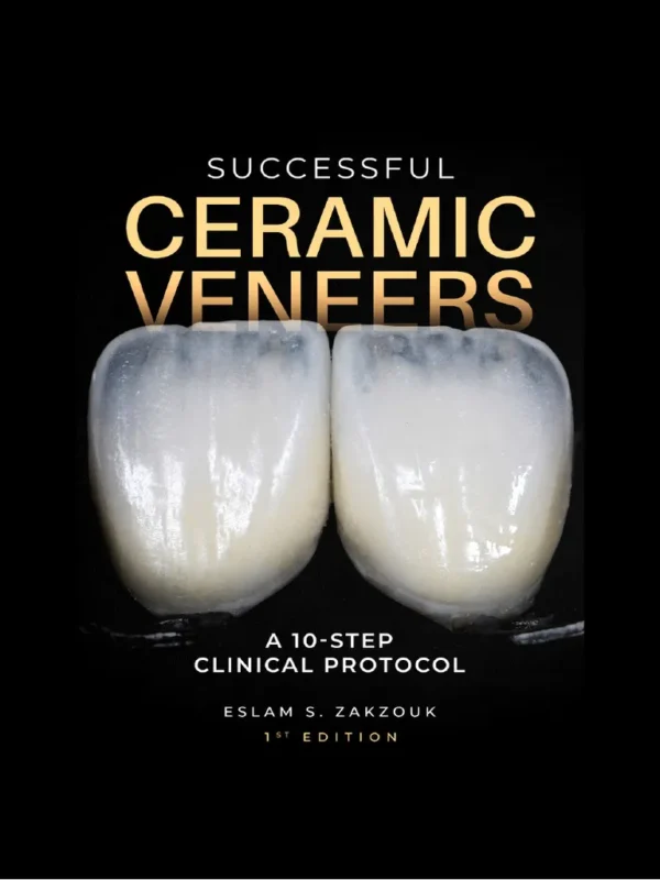 successful ceramic veneers