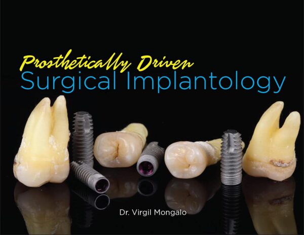 Prosthetically Driven Surgical Implantology