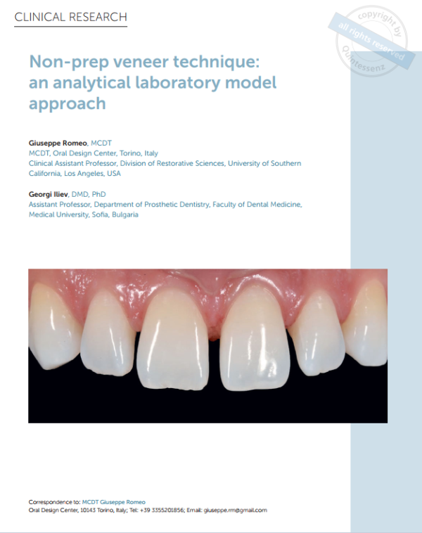 Non-prep veneer technique: an analytical laboratory model approach