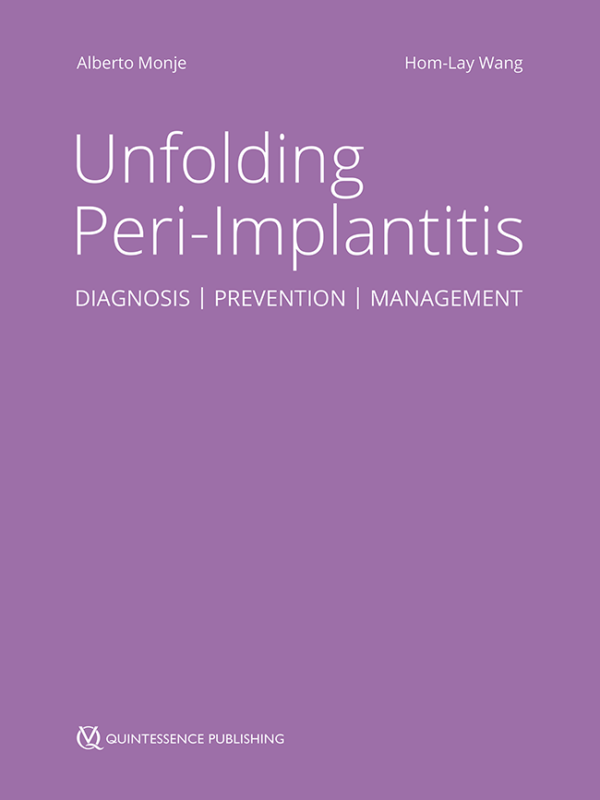 Unfolding Peri-Implantitis Diagnosis | Prevention | Management