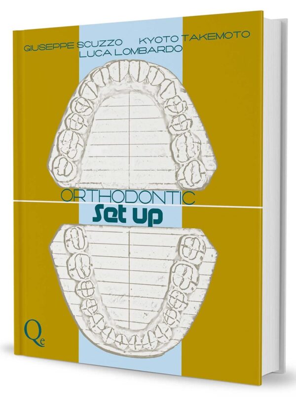 Orthodontic Setup 1st Edition