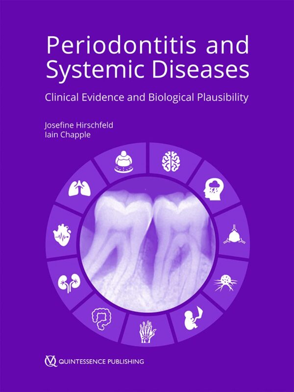 Periodontitis and Systemic Diseases: Clinical Evidence and Biological Plausibility – 30 July 2021