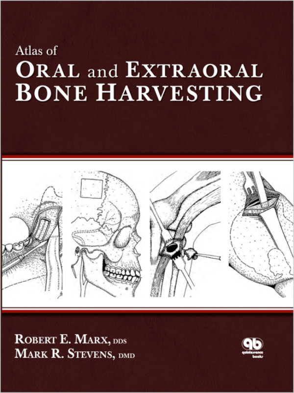 Atlas of Oral and Extraoral Bone Harvesting