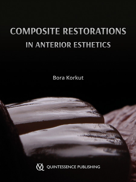 Esthetic Anterior Composite Restorations