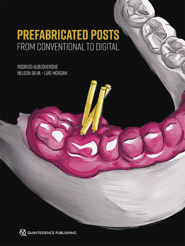 Prefabricated Posts From Conventional to Digital (EXCLUSIVE)